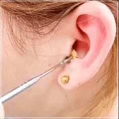 6Pcs Ear Wax Removal Kit Ear Wax Cleaning Tool