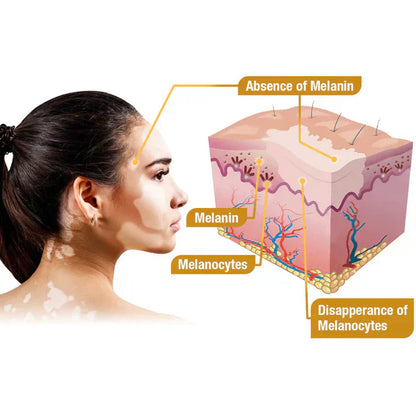 VitiGO™ Revitalizing Bee Venom Cream 🐝✨